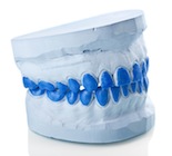 prótesis dental