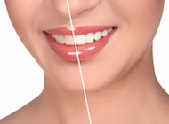 estética dental